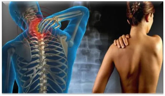 Qué es la fibromialgia síntomas y tratamiento dia-de-la-fibromialgia