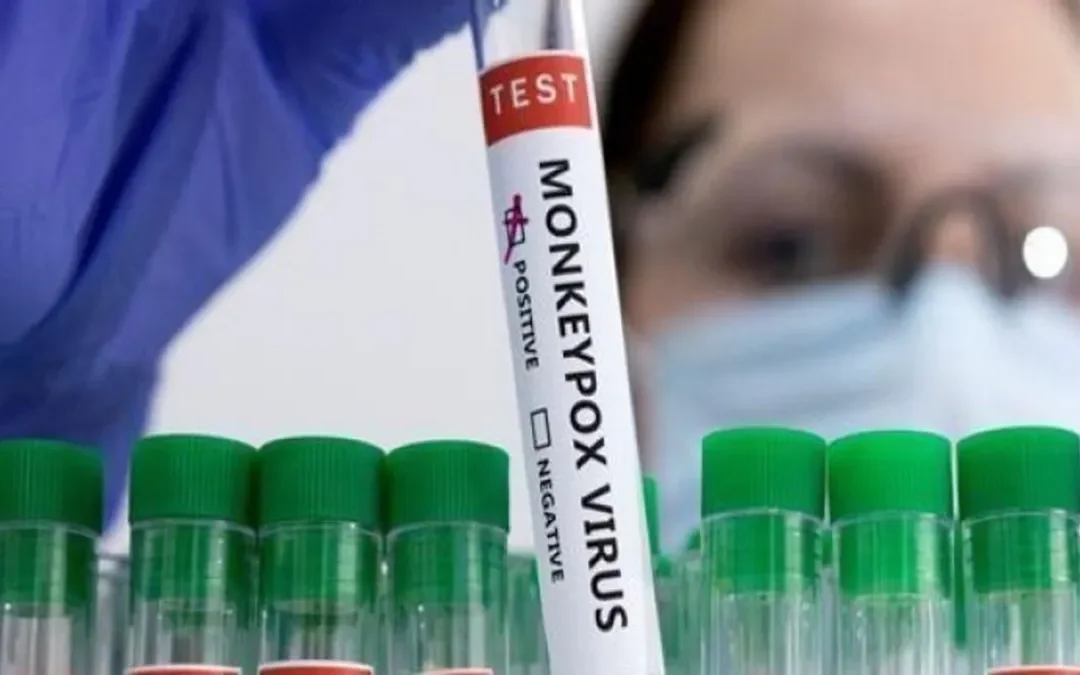 Por la viruela del mono la OMS declaró la emergencia pública y ya hubo casos en la Argentina