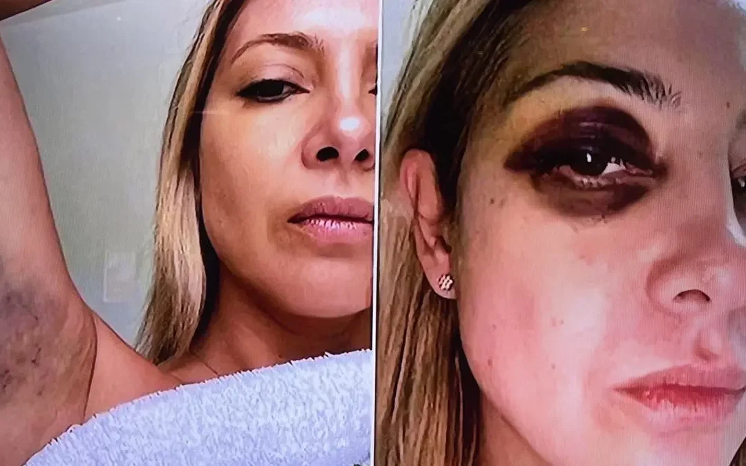 Se conocieron las fotos de la denuncia de Fabiola Yáñez contra Alberto Fernández